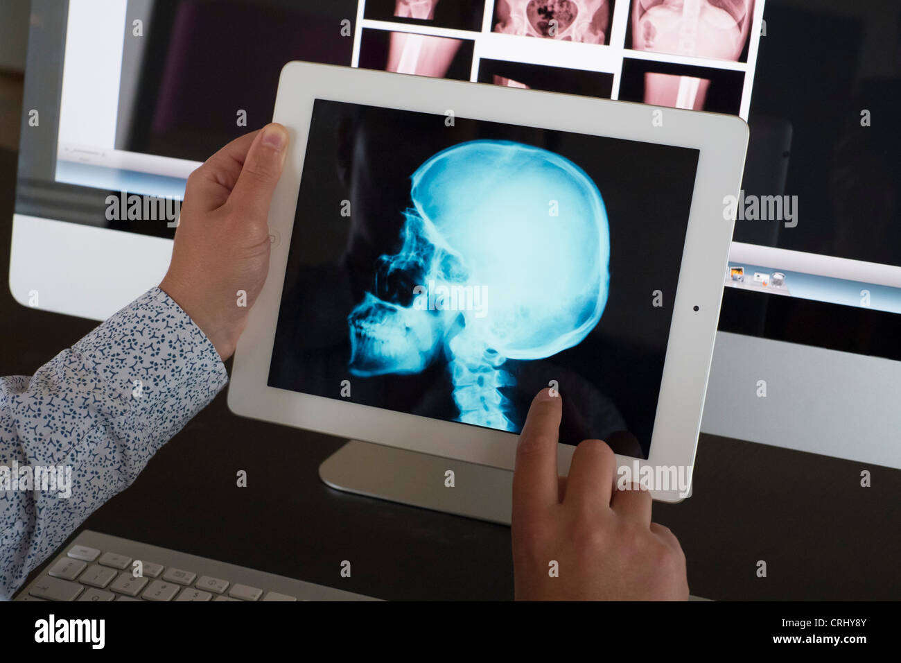 Doctor Using Ipad App To View Xray Images Of Patient Stock Photo Alamy Doctor Using Ipad App To View Xray Images Of Patient Stock Photo Alamy