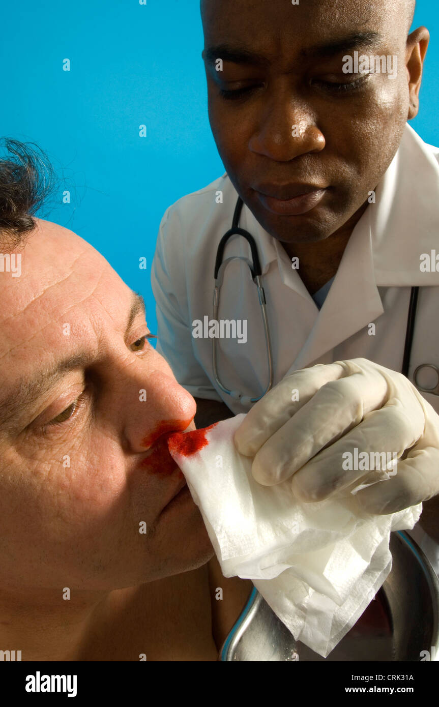 nursing nose bleed memory pictures nursing nose bleed memory pictures
