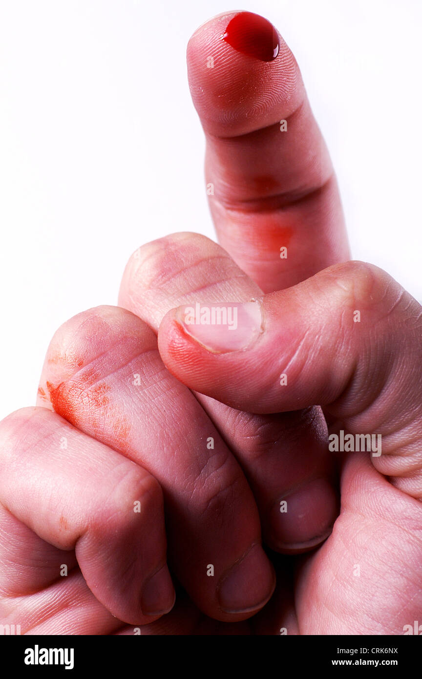 Cut Finger Blood Stock Photos & Cut Finger Blood Stock Images Alamy