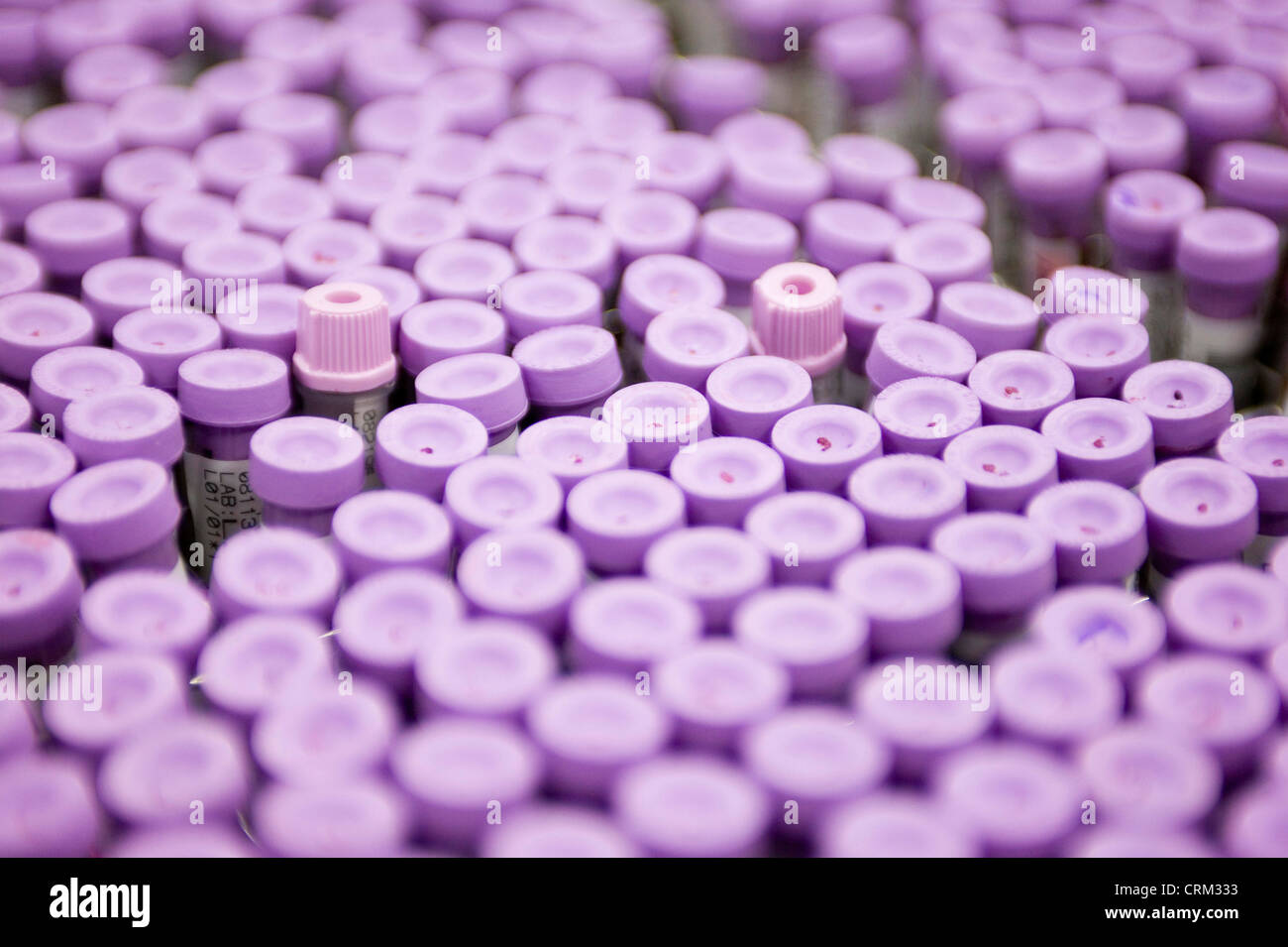 The tops of blood samples being tested and analysed Stock Photo Alamy