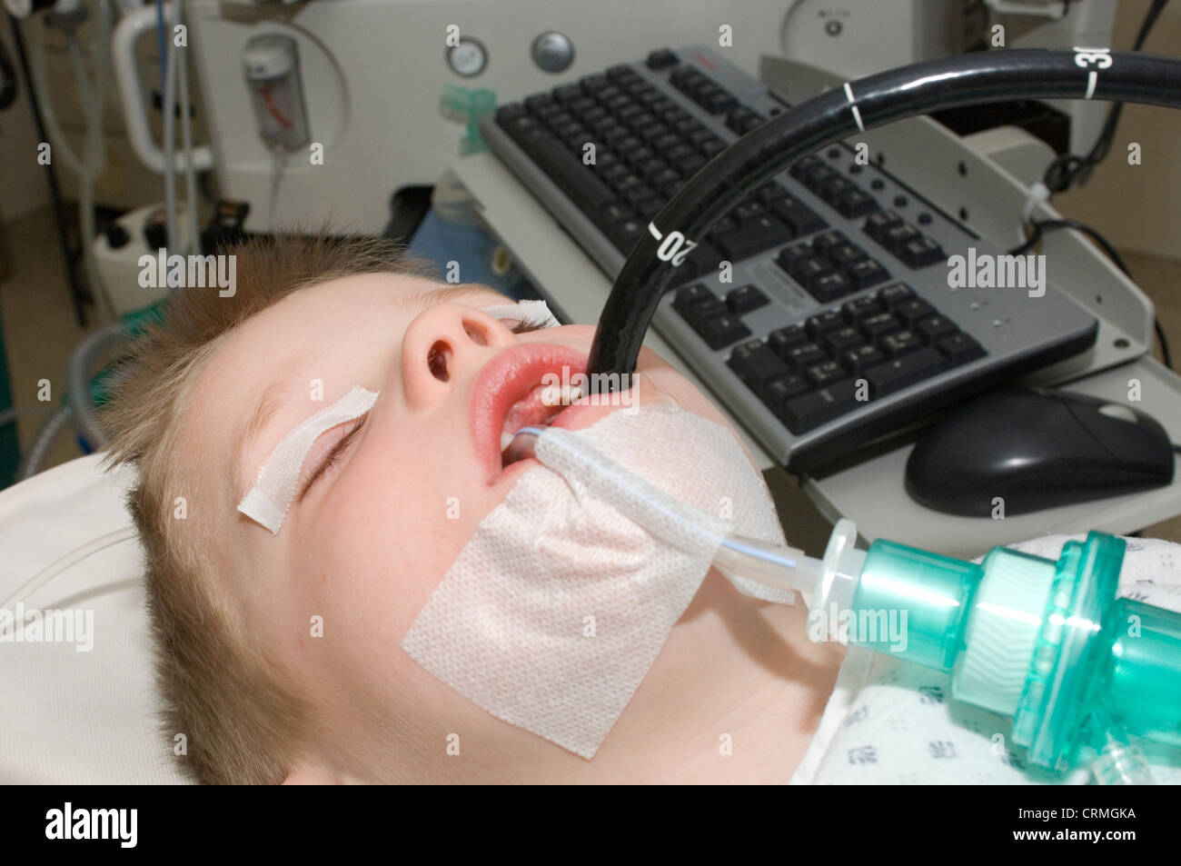 A young boy undergoing an endoscopic procedure Stock Photo Alamy