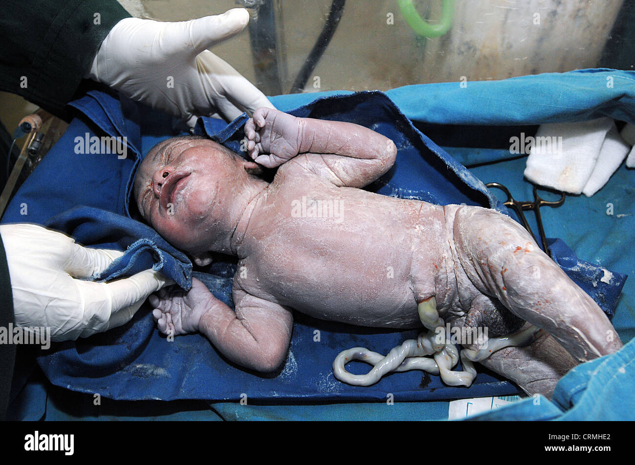 New Born Baby In Cot Soon After Birth Umbilical Cord Still Stock Photo Alamy