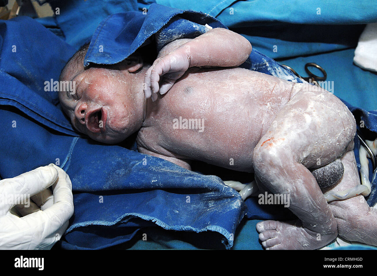 A nurse prepares to clean a new born baby, soon after birth (umbilical