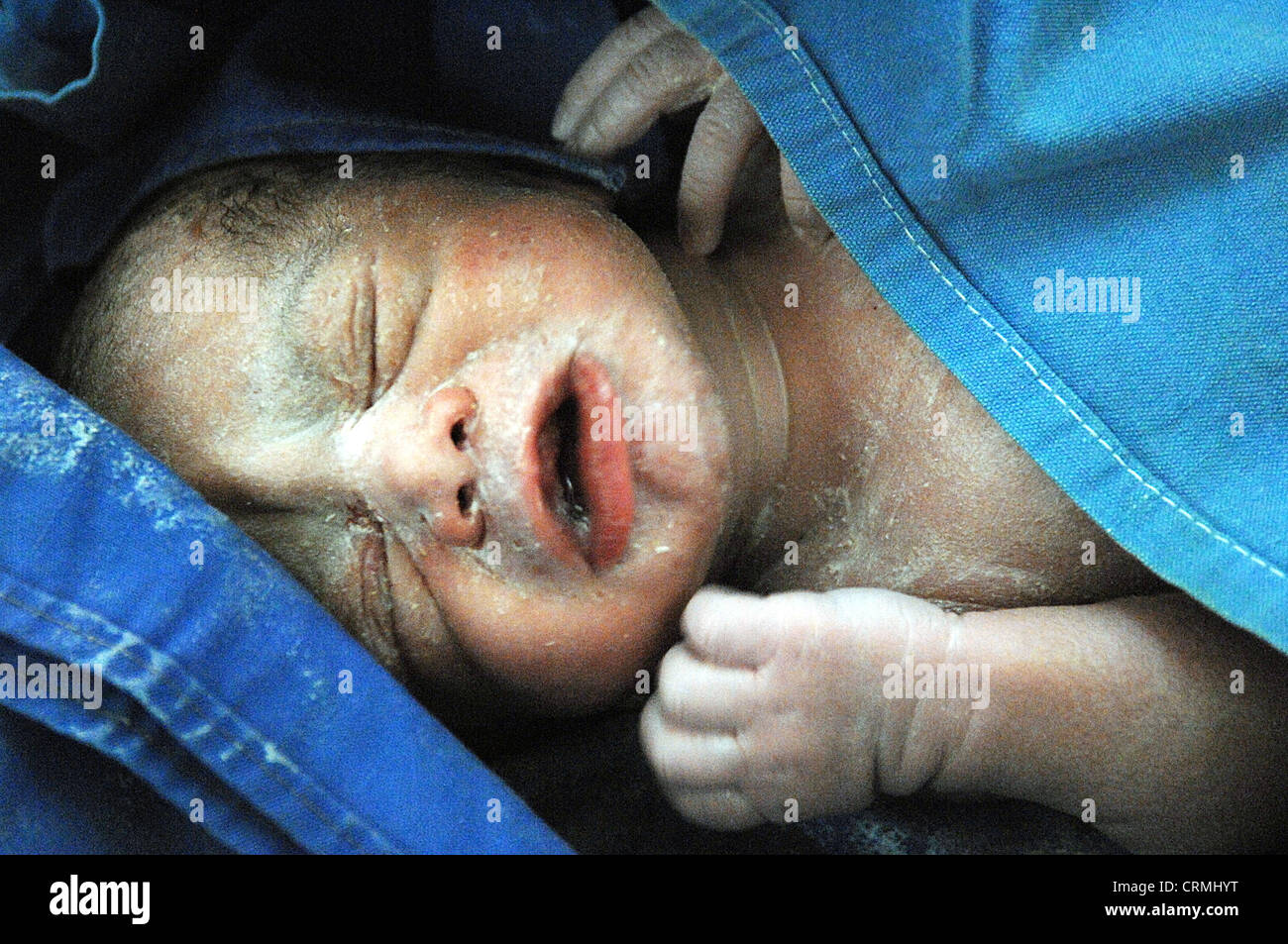 Close up of face of a new born baby soon after birth. Stock Photo