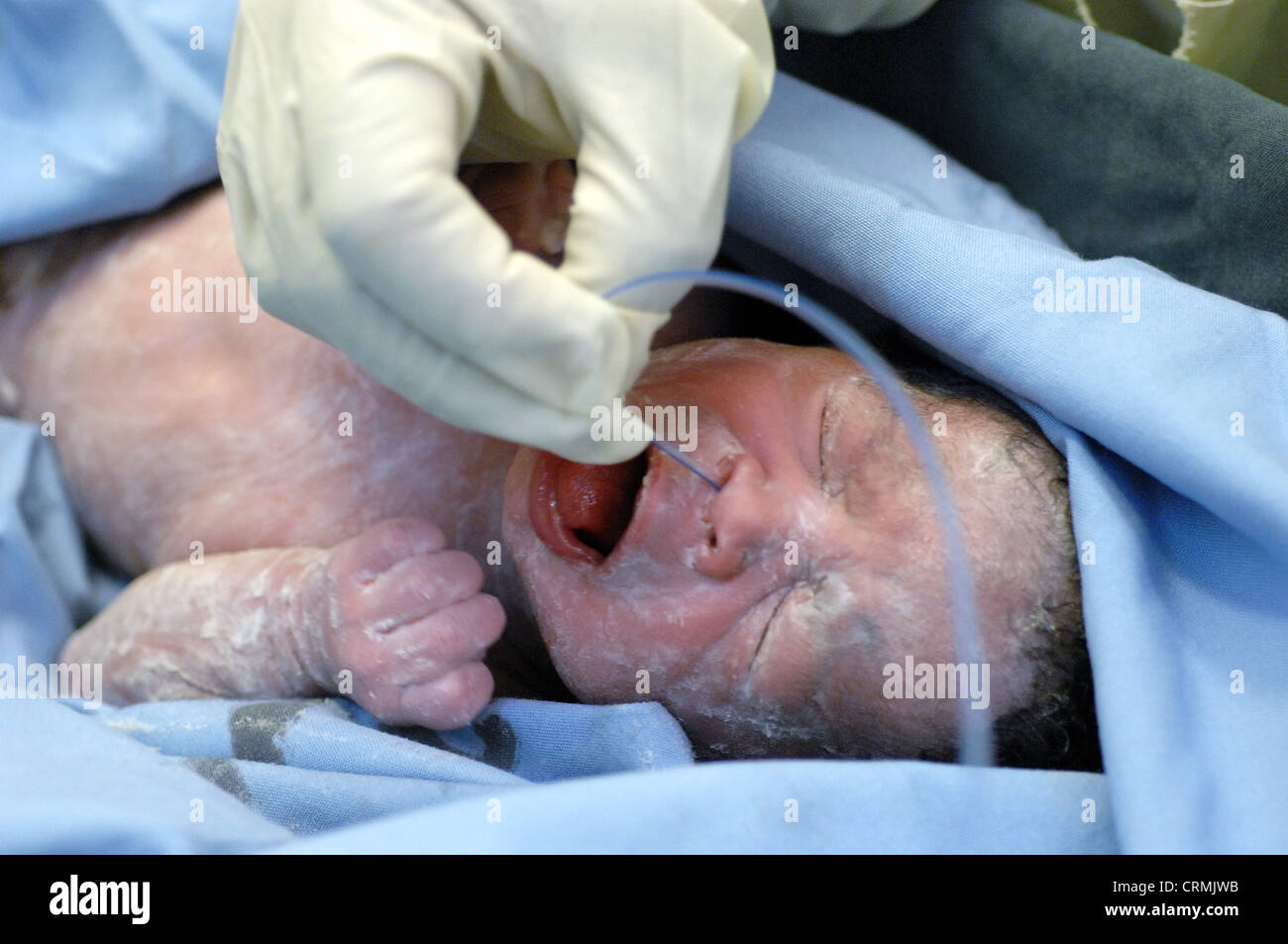 A gloved hand place a small suction into the mouth of a new born baby, to remove unwanted mucus. Stock Photo