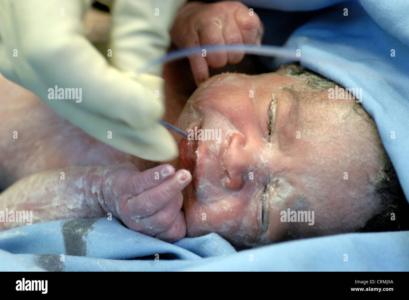 newborn baby suction