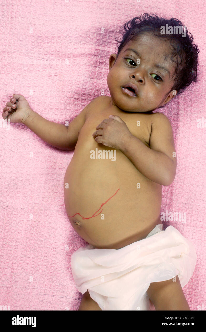 small baby in hospital bed very ill Stock Photo