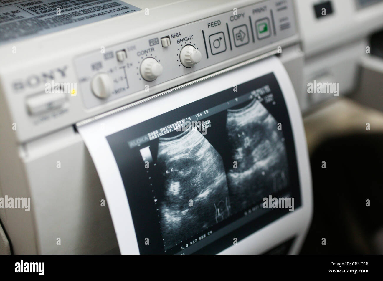 dekorere Hende selv logik A print out of an ultrasound recording (showing abdominal area Stock Photo  - Alamy