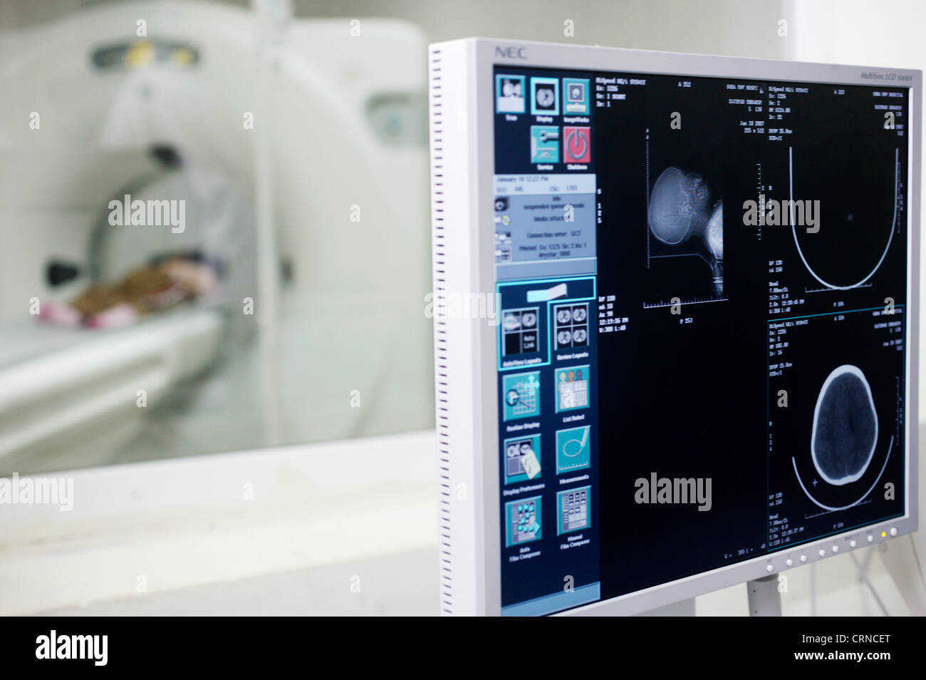 A patient undergoes a CT (Computer Tomography) - Control screen of a CT scan (foreground) CT Scanner with patient (background). Stock Photo