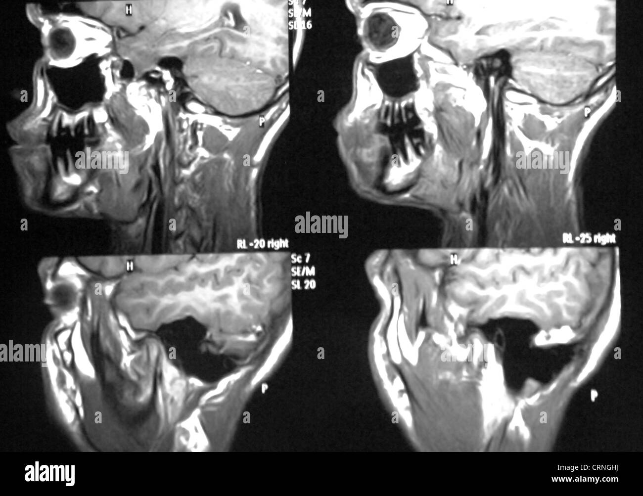 Cat Scan Stock Photo