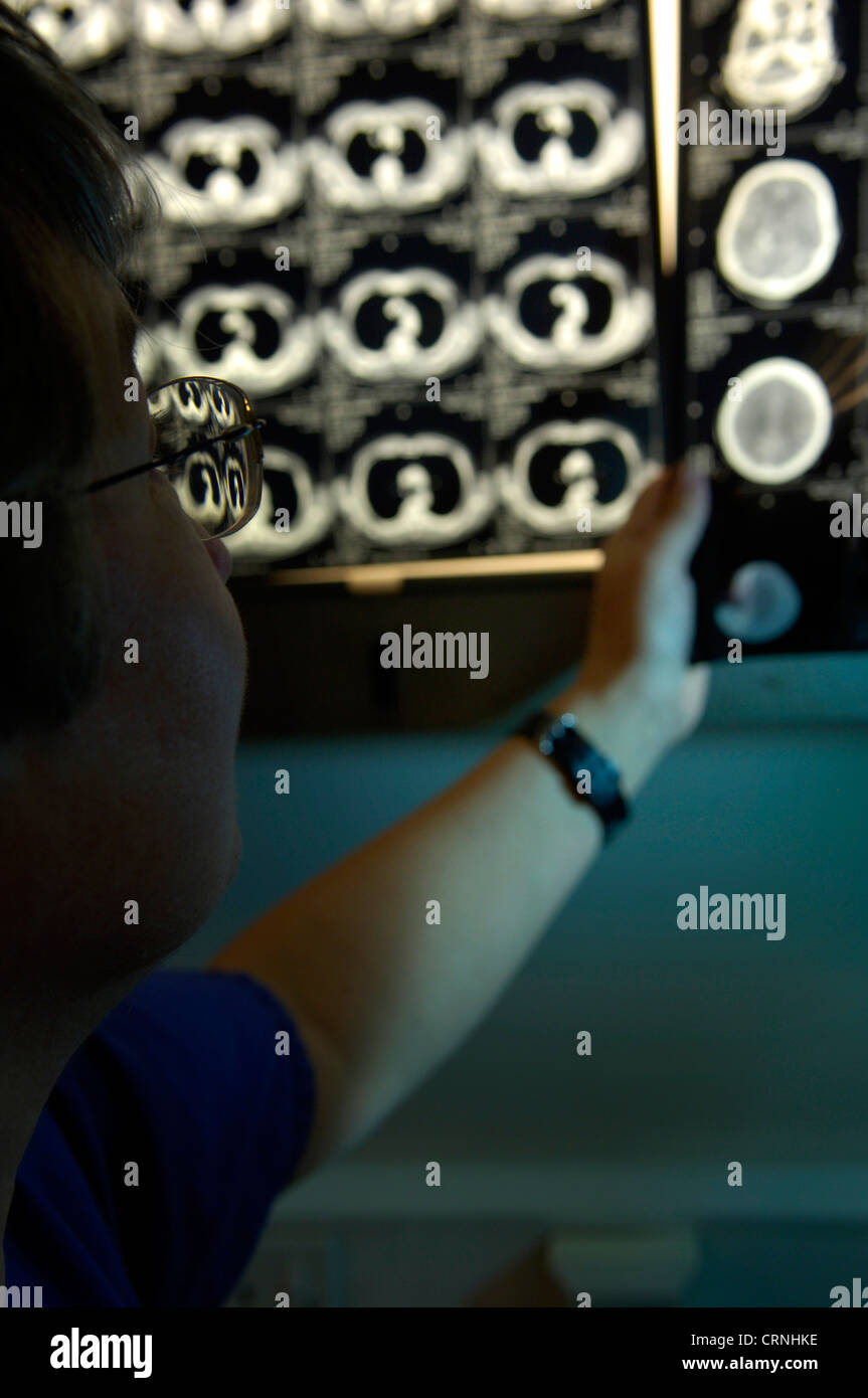 A doctor examines a patient's x-ray Stock Photo