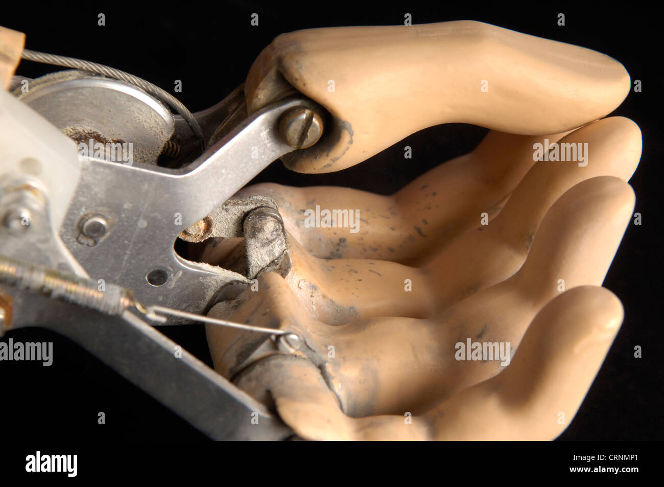 Artificial Cable Operated False Limb hand Stock Photo - Alamy