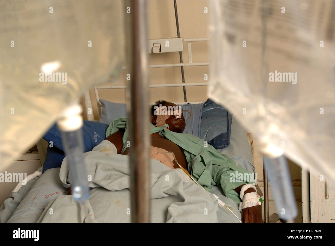 Image shows comatosed snake bite victim. The victim is on peritoneal dialysis. Stock Photo