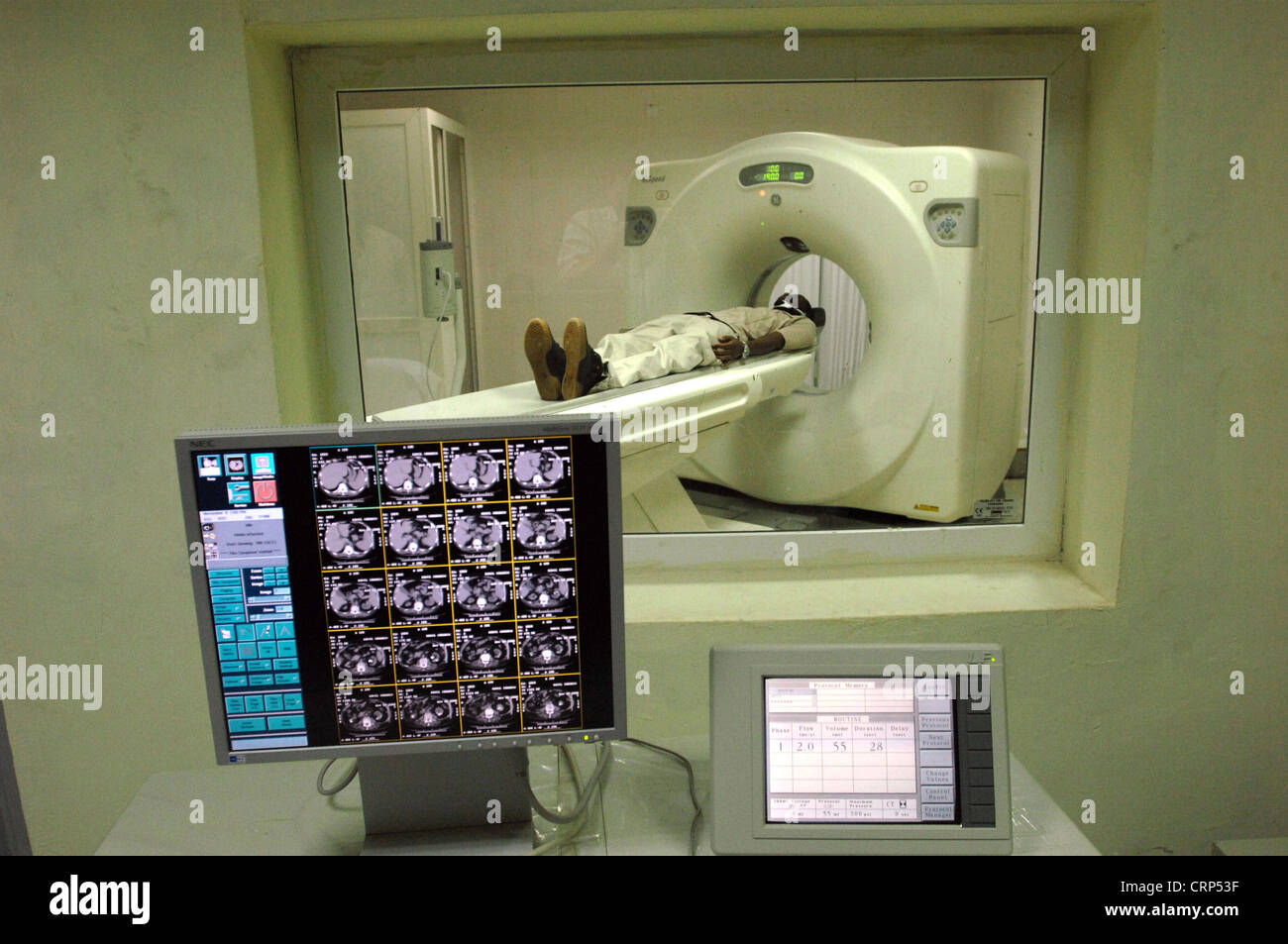 A patient undergoes a CT (Computer Tomography) scan - Control screen of a CT scan (foreground) CT Scanner with patient (background). Stock Photo