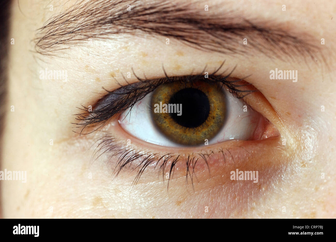 Dilated Pupils Vs Normal