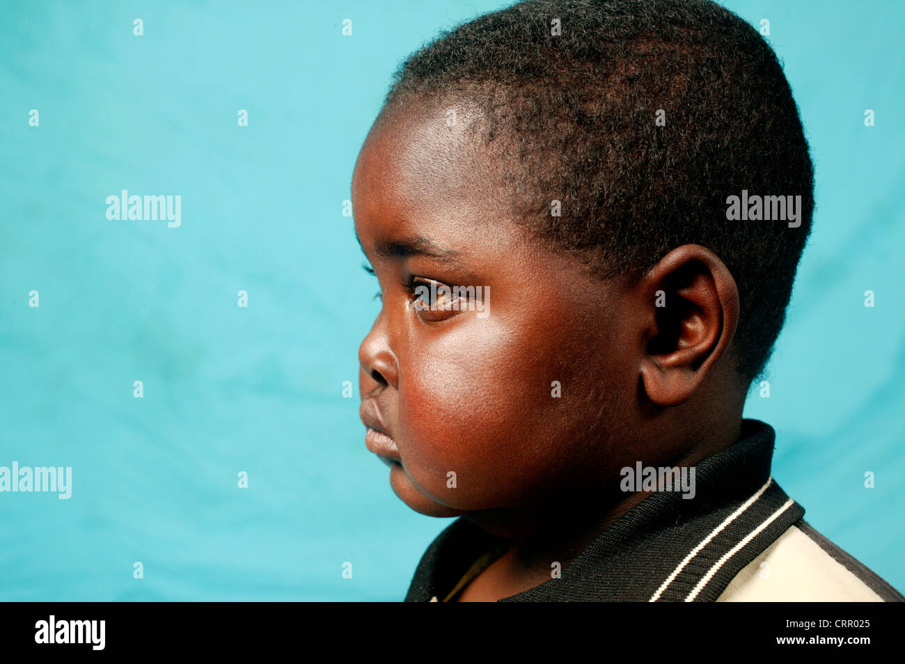 Portrait of an african man with Down syndrome is in an African village.  Stock Photo