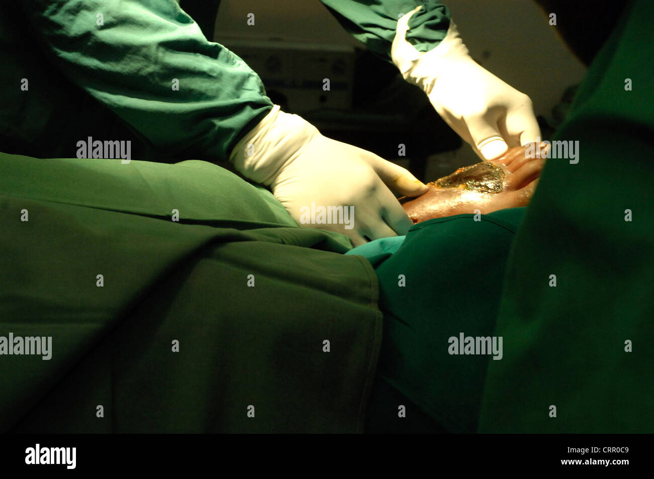 Surgeon operating on the foot of a patient Stock Photo