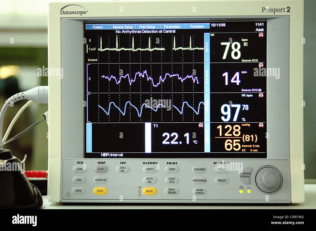 Cardiac Monitor High Resolution Stock Photography and Images - Alamy