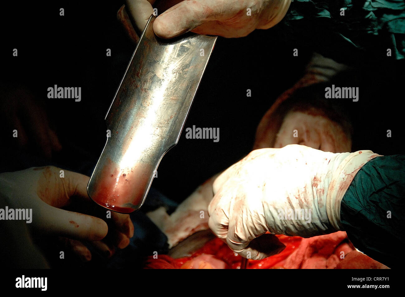 Surgery Stock Photo