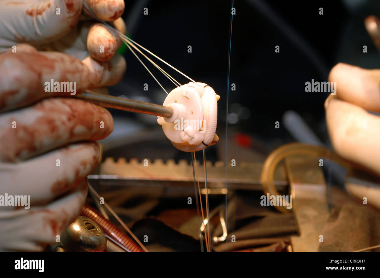 Artificial Connection Equipment being used on heart valves Stock Photo