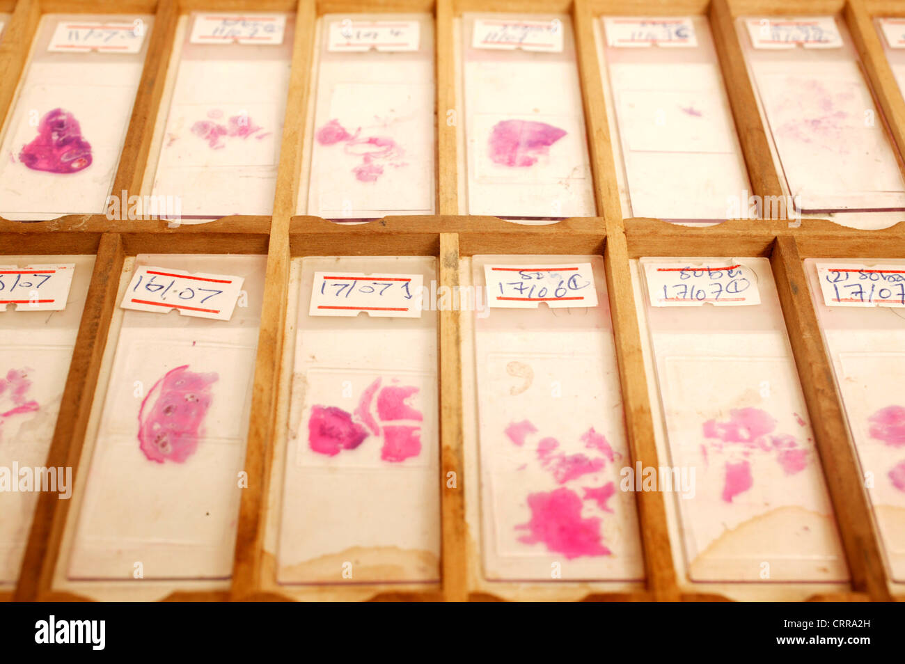 Various cytology slides in a rack. Stock Photo