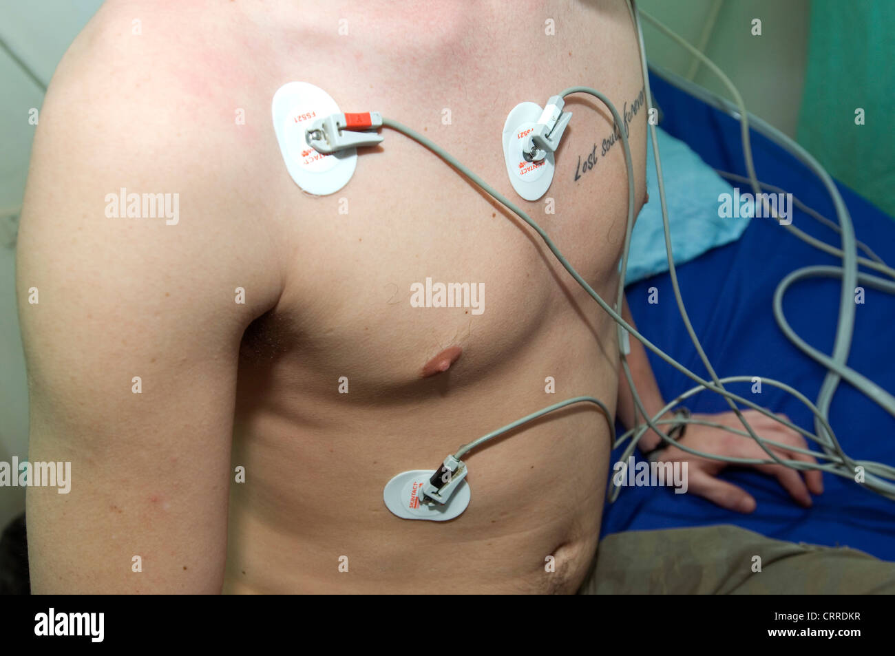 A patient in hospital bed with electrodes measuring his heart beat