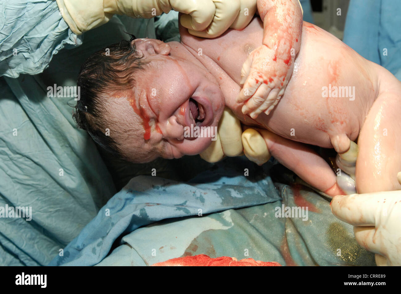 The obstetrician hands the baby over to the pediatric team who will assess it's status. Stock Photo