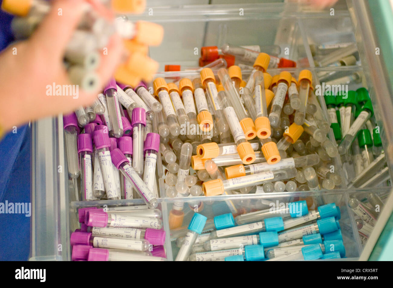 Kidney disease blood containers Stock Photo - Alamy
