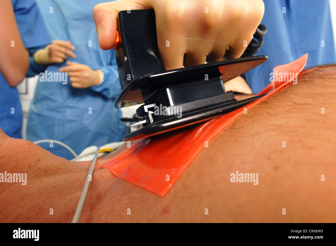 Doctors using a defibrillator to resuscitate a male heart attack victim. Stock Photo