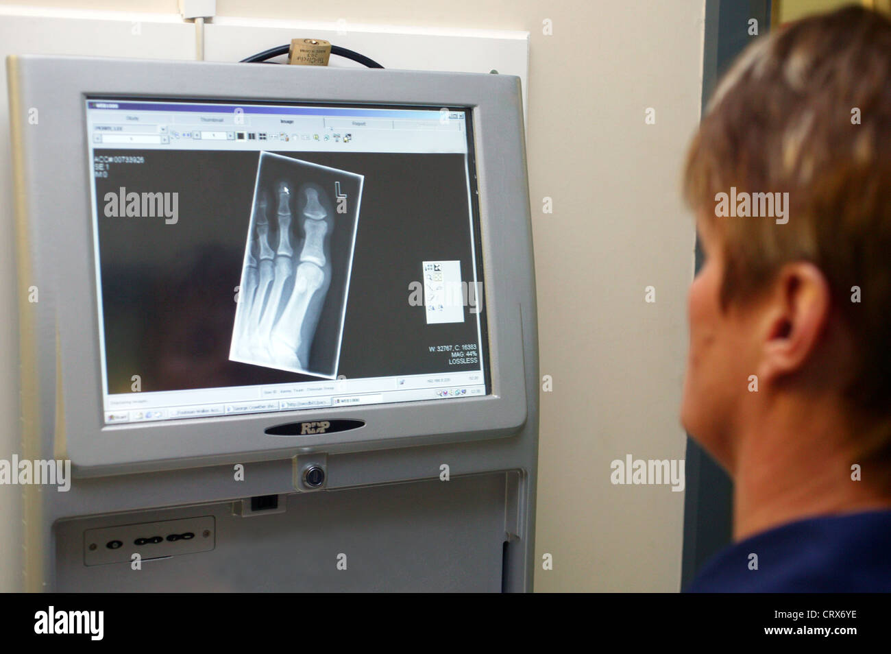A female nurse looks at a digital x-ray on a computer. Stock Photo