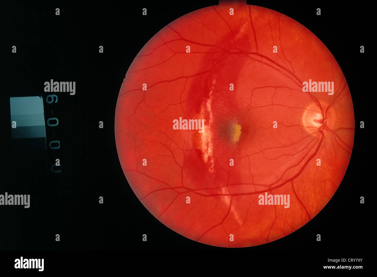 Retinography hires stock photography and images Alamy