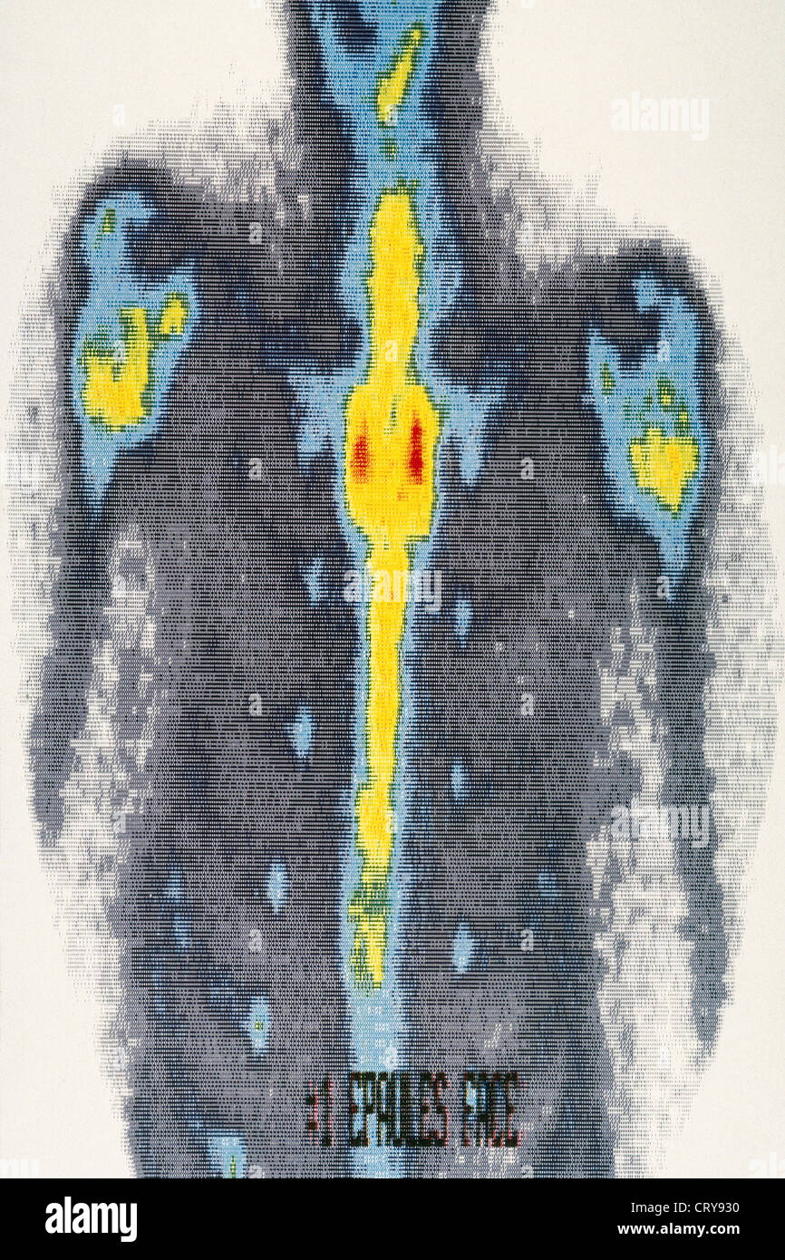 Radioactive Tracer Stock Photos & Radioactive Tracer Stock Images Alamy