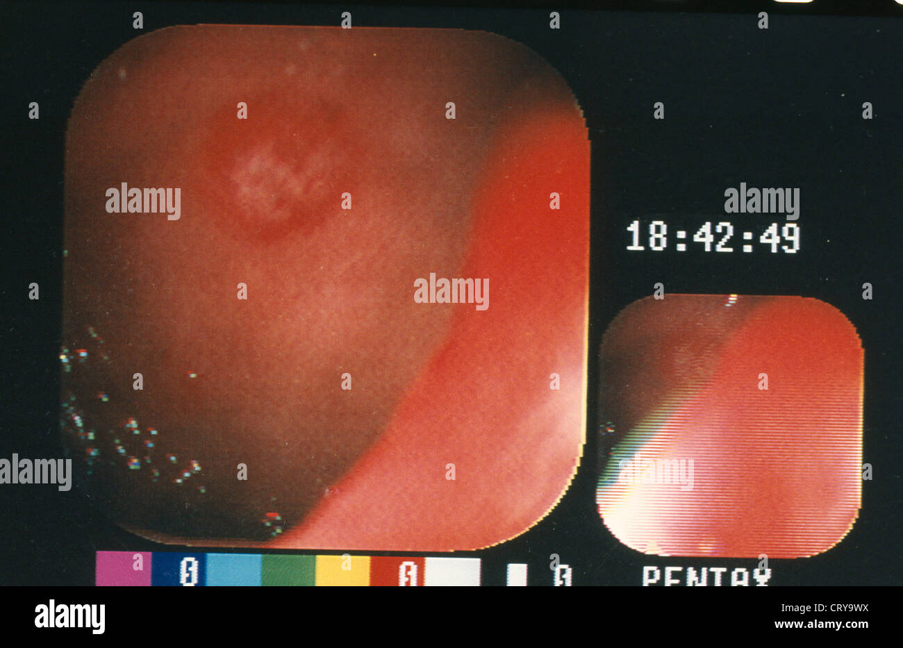 Besnier boeck hires stock photography and images Alamy