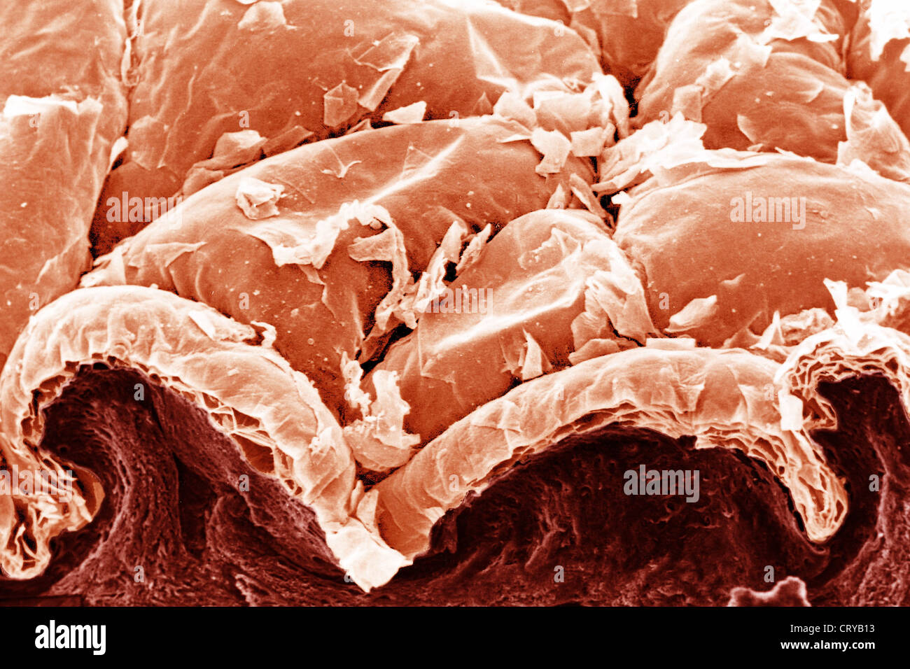 SKIN, SEM Stock Photo