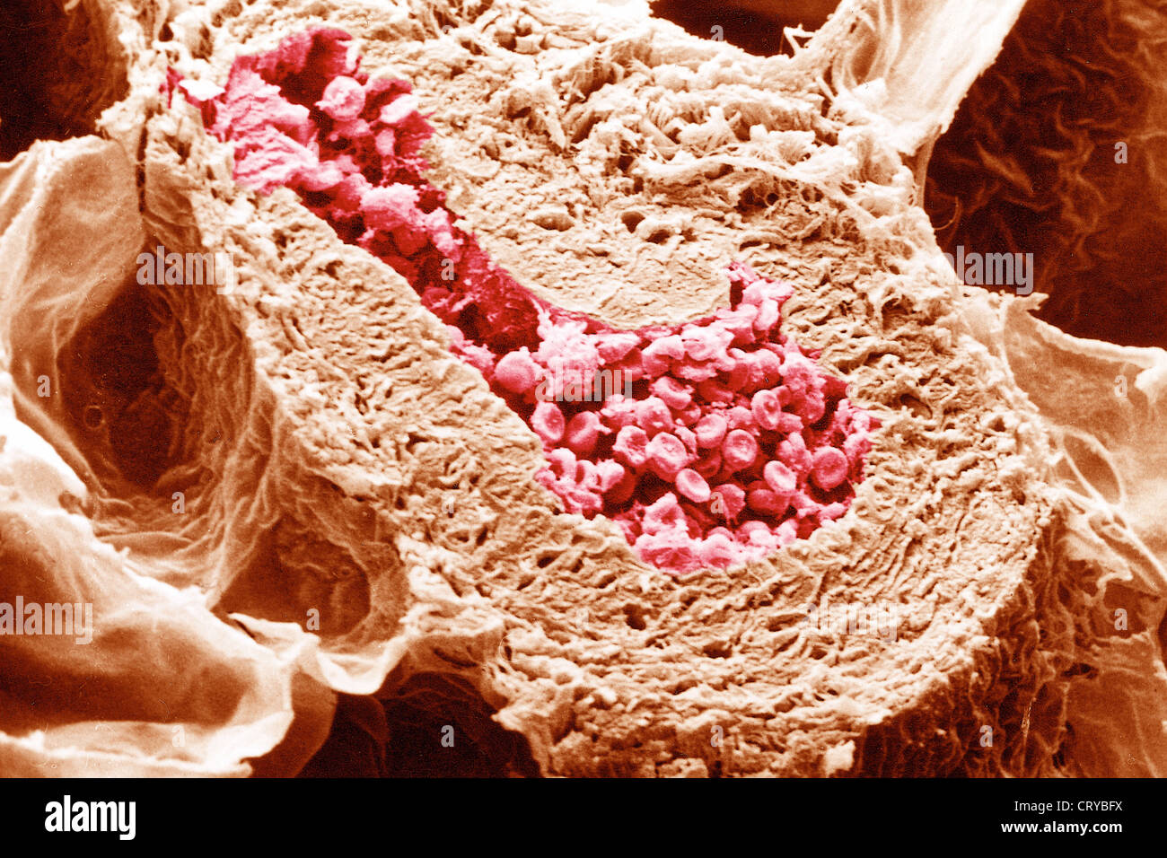 ARTERY, SEM Stock Photo