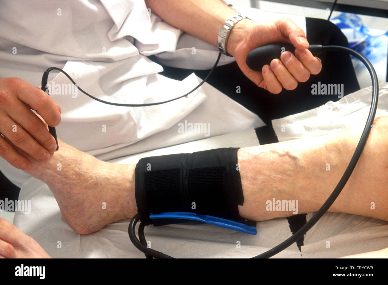 ankle-brachial-index-stock-photo-alamy