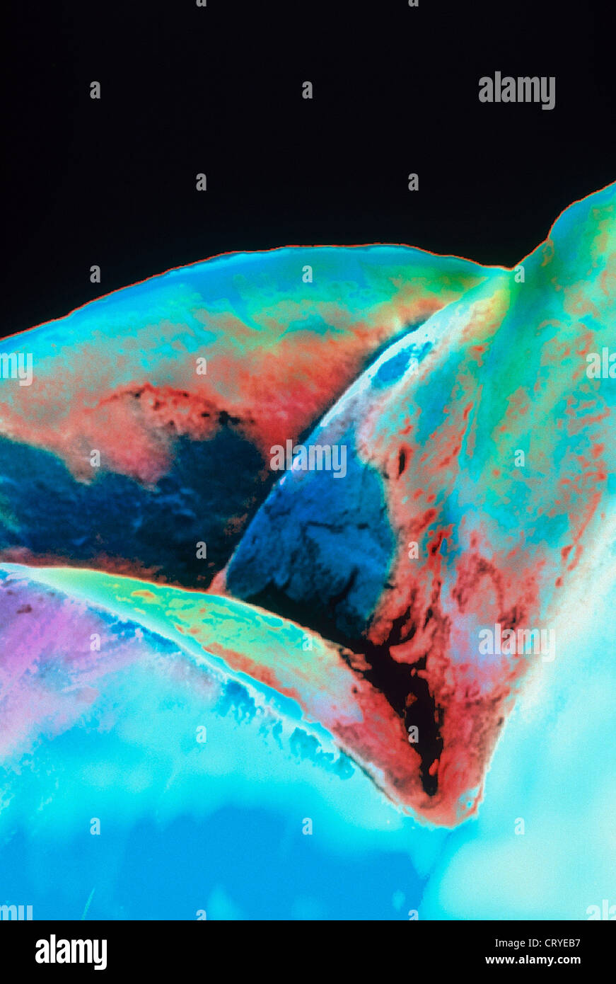 Tooth Sem Tooth surface microscope hi-res stock photography and images - Alamy