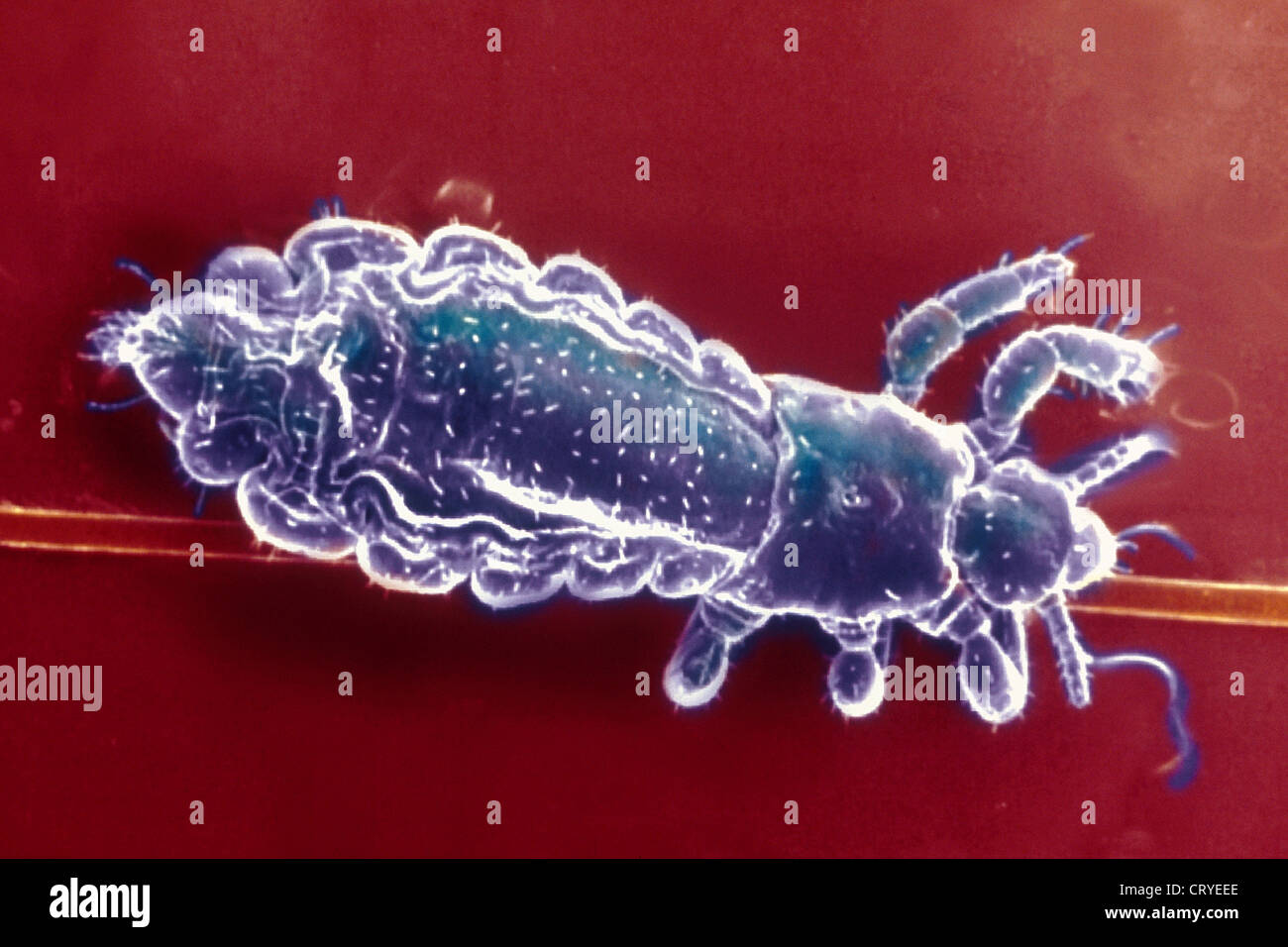 HUMAN HEAD LOUSE, SEM Stock Photo