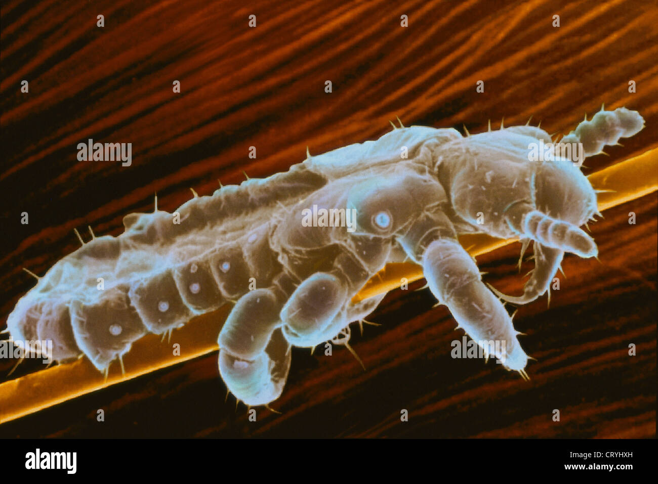 Lice Under A Microscope