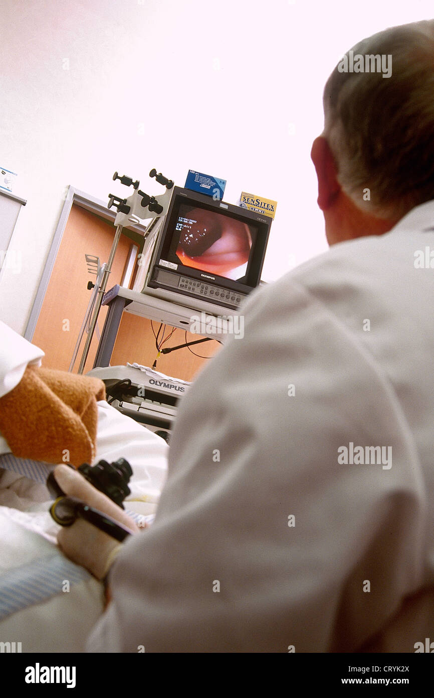 COLON, ENDOSCOPY EXAMINATION Stock Photo Alamy