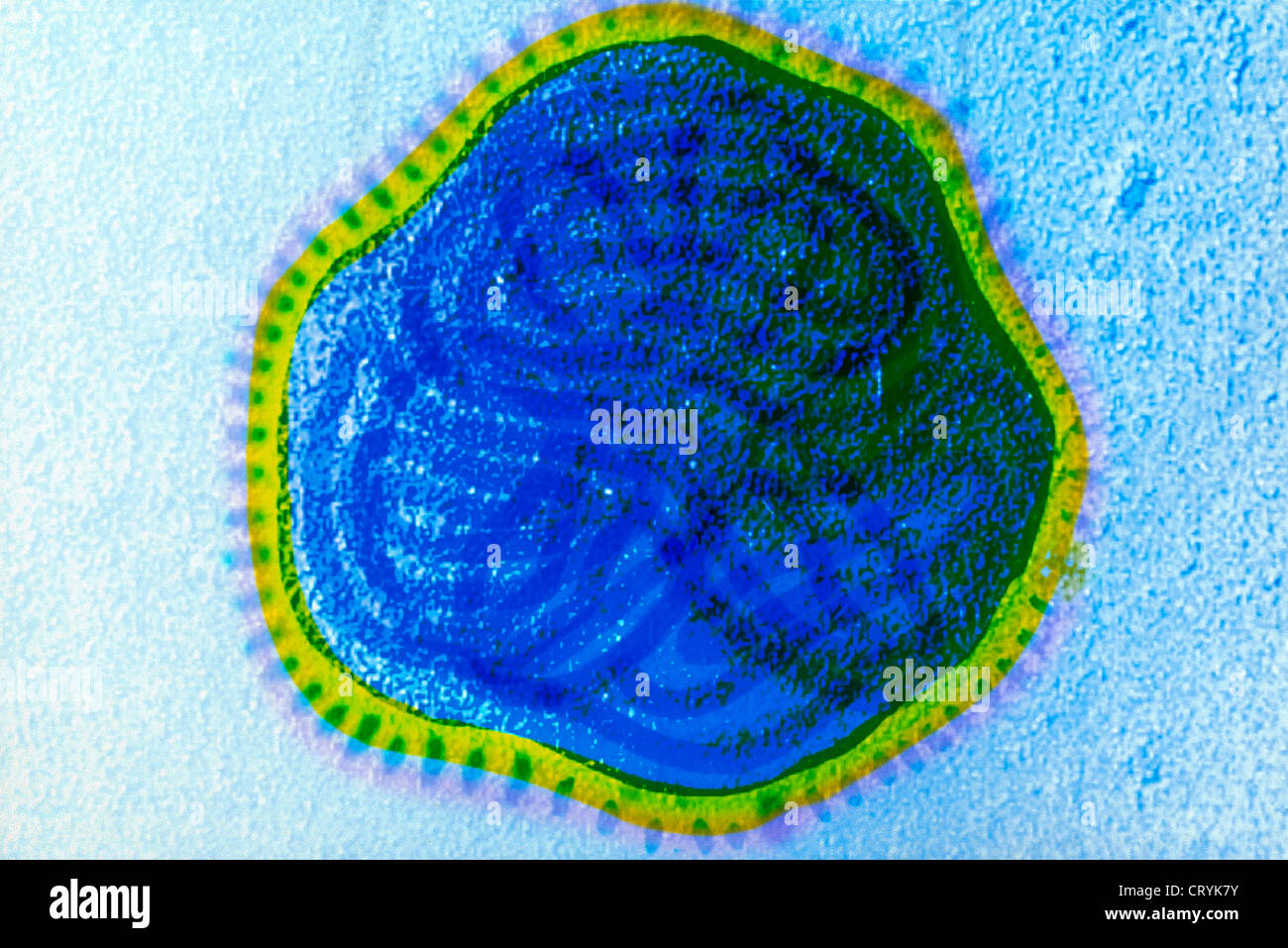 Measles Virus Micrograph Hi Res Stock Photography And Images Alamy