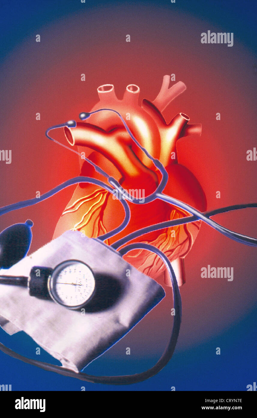 HIGH BLOOD PRESSURE, DRAWING Stock Photo Alamy