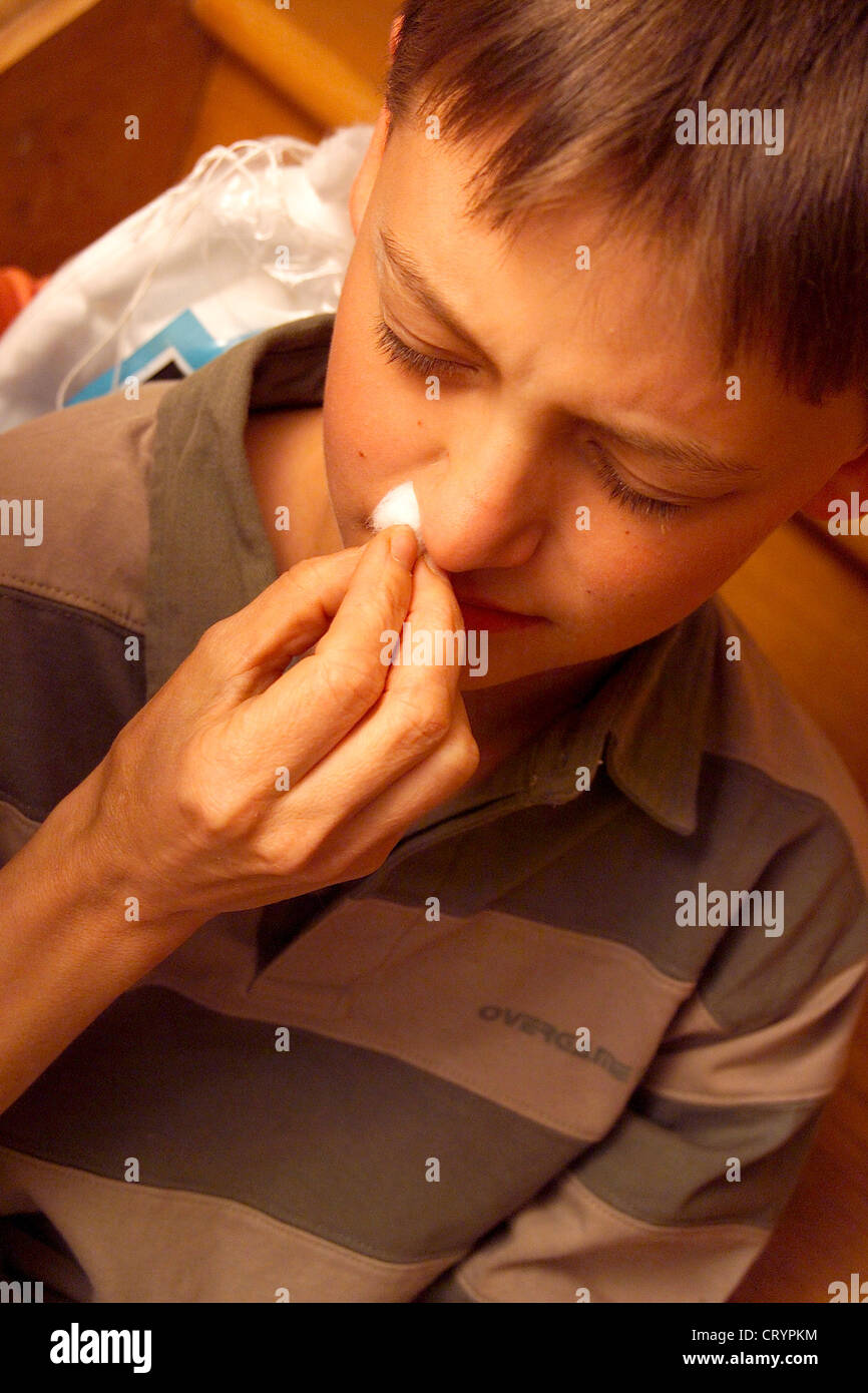 Nosebleed child hires stock photography and images Alamy