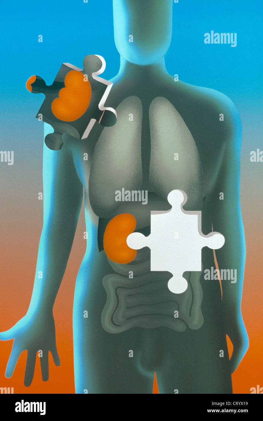 TRANSPLANT KIDNEY, ILLUSTRATION Stock Photo Alamy