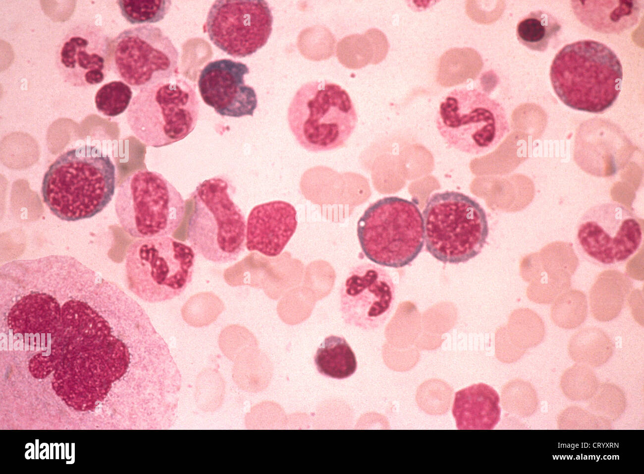 BONE MARROW EXAMINATION Stock Photo Alamy