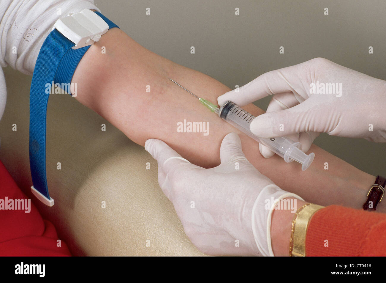 BLOOD SPECIMEN IN A WOMAN Stock Photo - Alamy