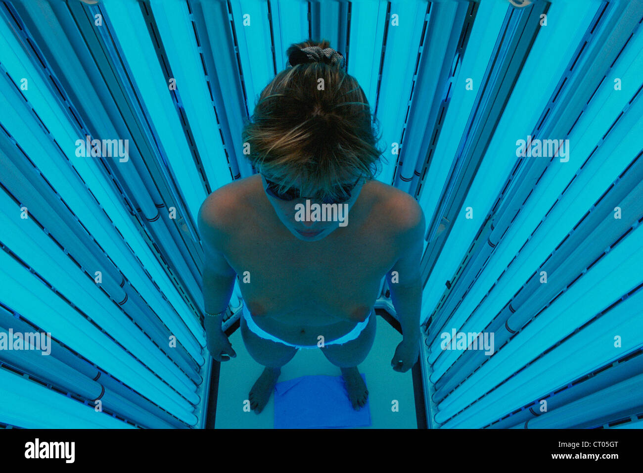 PUVA THERAPY Stock Photo: 49176872 - Alamy