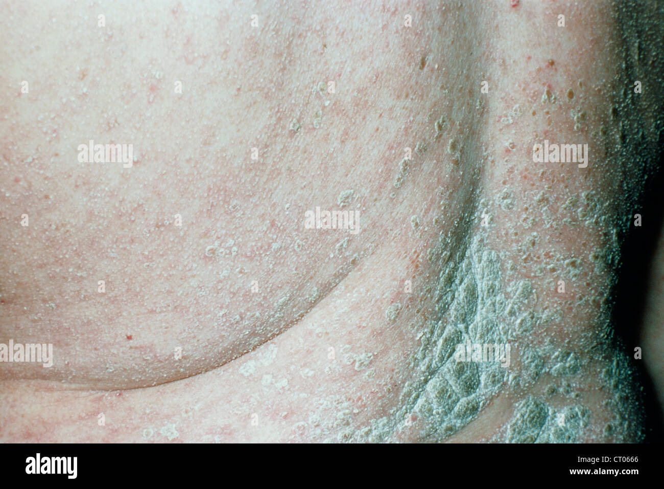 Spring avitaminosis. Do you have it Spring avitaminosis. Do you have it