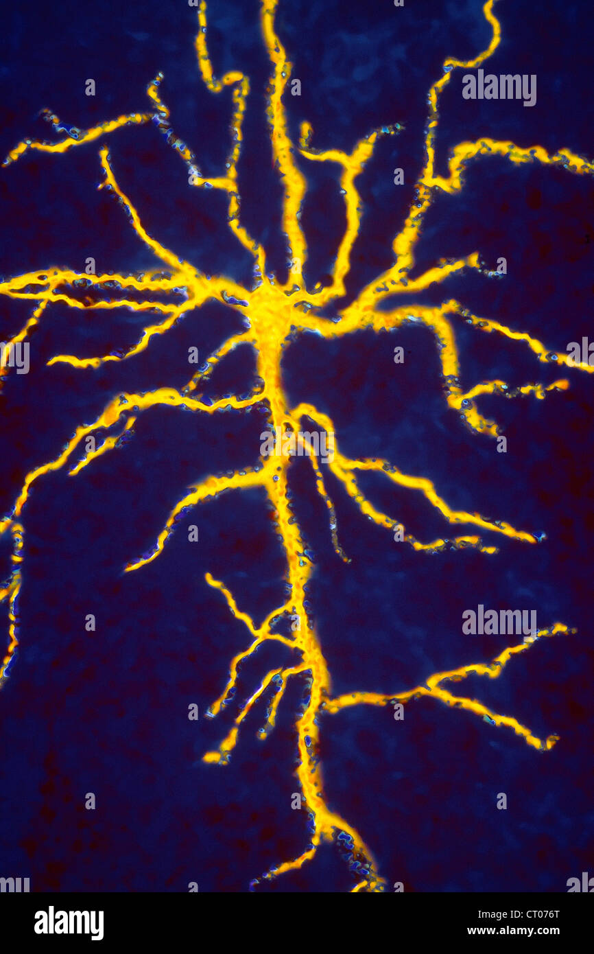 Neuron micrograph hi-res stock photography and images - Alamy