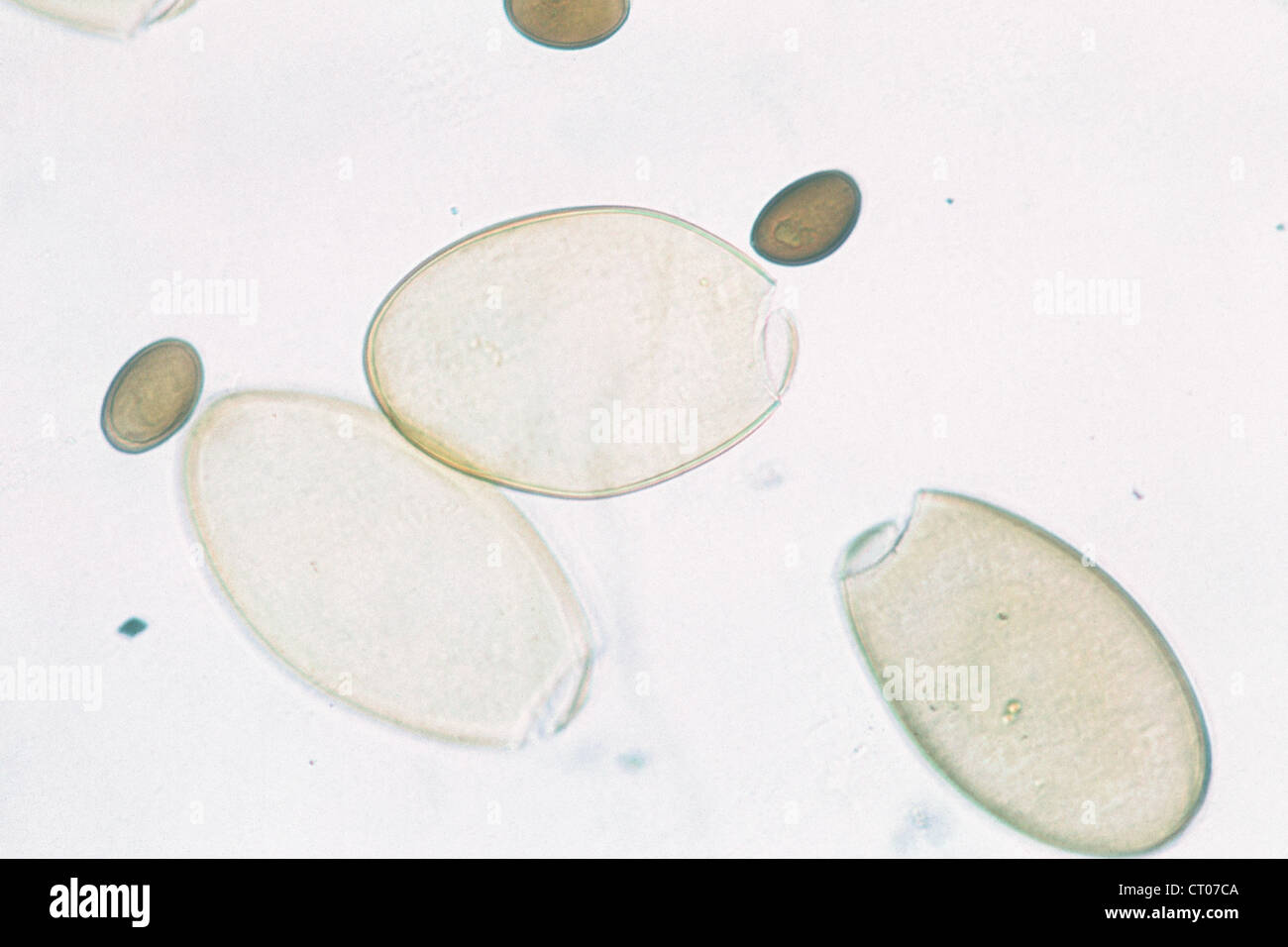 Liver fluke egg hi-res stock photography and images - Alamy